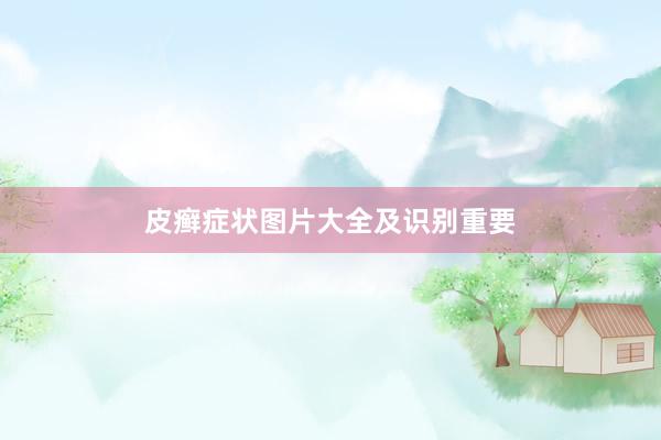 皮癣症状图片大全及识别重要